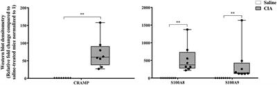 Cathelicidin and Calprotectin Are Disparately Altered in Murine Models of Inflammatory Arthritis and Airway Inflammation